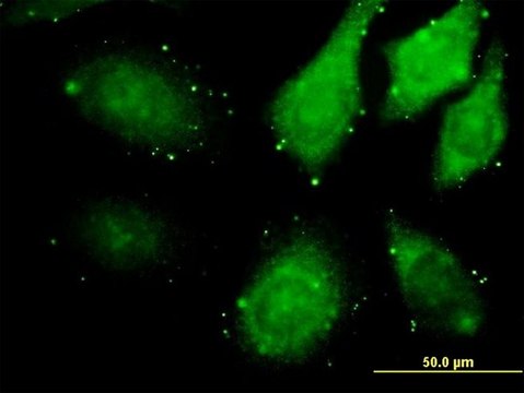 Monoclonal Anti-ZAK antibody produced in