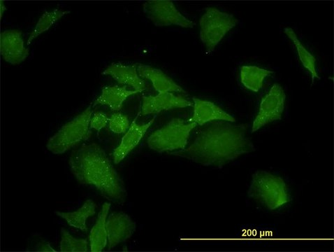 Monoclonal Anti-ANKRA2 antibody produced in
