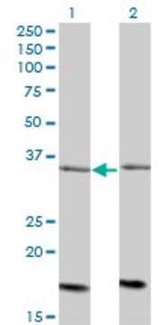 Monoclonal Anti-ADCK4 antibody produced in