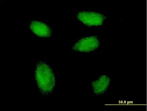Monoclonal Anti-HBXAP antibody produced in