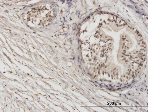 Monoclonal Anti-ZNF92 antibody produced in