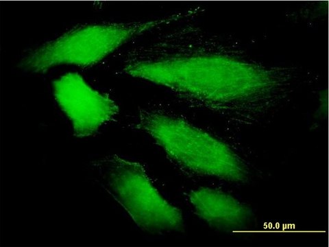 Monoclonal Anti-DDEF1 antibody produced in