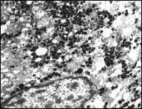 Anti-Rabbit IgG (whole molecule)–Gold antibody