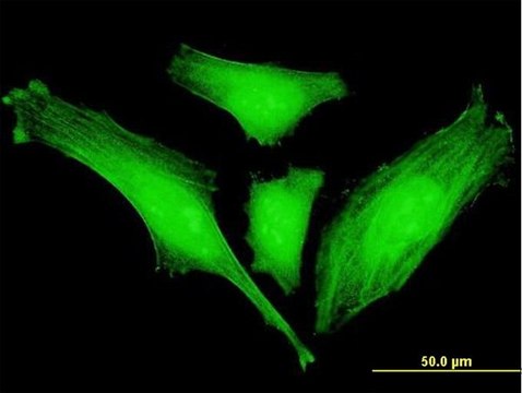 Monoclonal Anti-SLC2A4RG antibody produced in