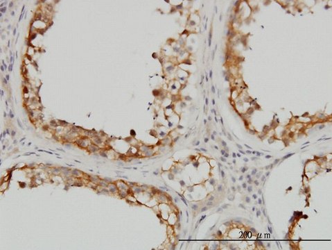 Monoclonal Anti-SDSL antibody produced in