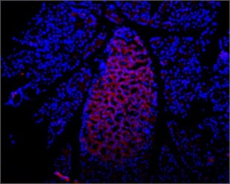 Anti-Purinergic Receptor P2X? (extracellular) antibody