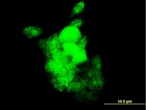 Monoclonal Anti-SMOC1 antibody produced in