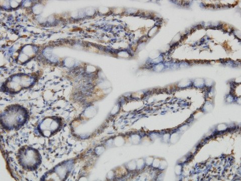 Monoclonal Anti-ACBD3 antibody produced in