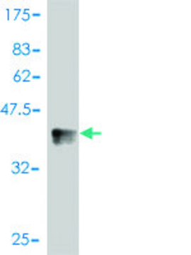 Monoclonal Anti-NLK antibody produced in