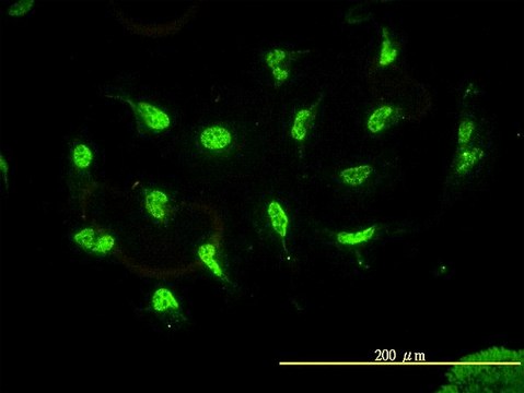 Monoclonal Anti-HDAC11 antibody produced in