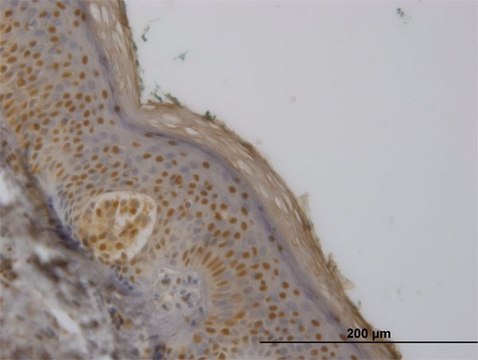 Monoclonal Anti-FBXO11 antibody produced in