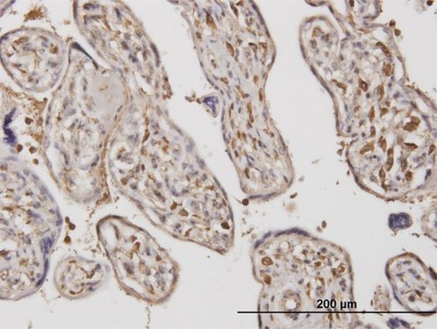 Monoclonal Anti-ADAMTS17 antibody produced in