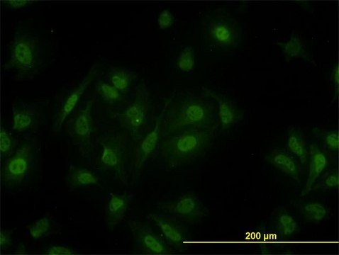 Monoclonal Anti-PCQAP antibody produced in