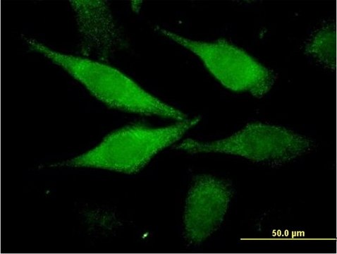 Monoclonal Anti-C1orf80 antibody produced in
