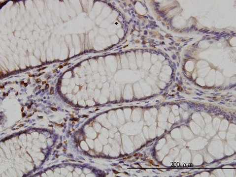 Monoclonal Anti-CDK5RAP3 antibody produced in
