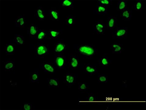 Monoclonal Anti-VPS25 antibody produced in