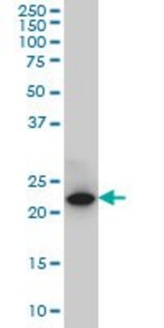 Monoclonal Anti-C13orf1 antibody produced in