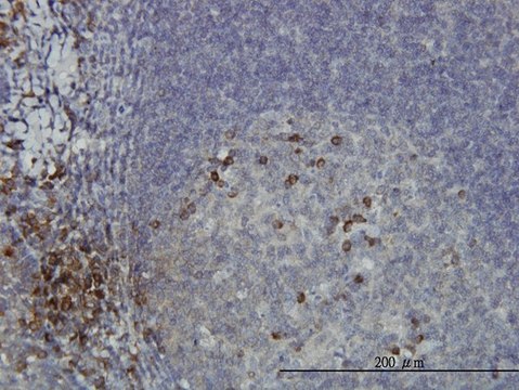 Monoclonal Anti-DCAKD antibody produced in