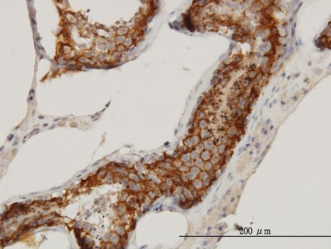 Monoclonal Anti-FATE1 antibody produced in