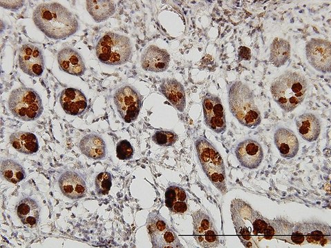 Monoclonal Anti-ABHD5 antibody produced in