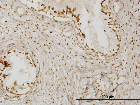 Monoclonal Anti-KLHDC4 antibody produced in