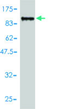Monoclonal Anti-TDP1 antibody produced in