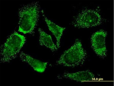 Monoclonal Anti-MOGAT3 antibody produced in