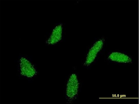 Monoclonal Anti-UBE2U antibody produced in