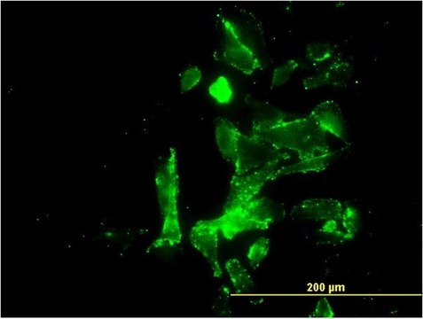 Monoclonal Anti-FKSG14 antibody produced in