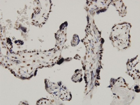 Monoclonal Anti-CARF antibody produced in