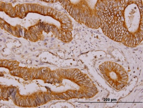Monoclonal Anti-NDRG4 antibody produced in