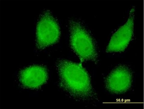 Monoclonal Anti-CBLL1 antibody produced in