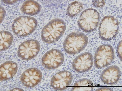 Monoclonal Anti-ACSL5 antibody produced in